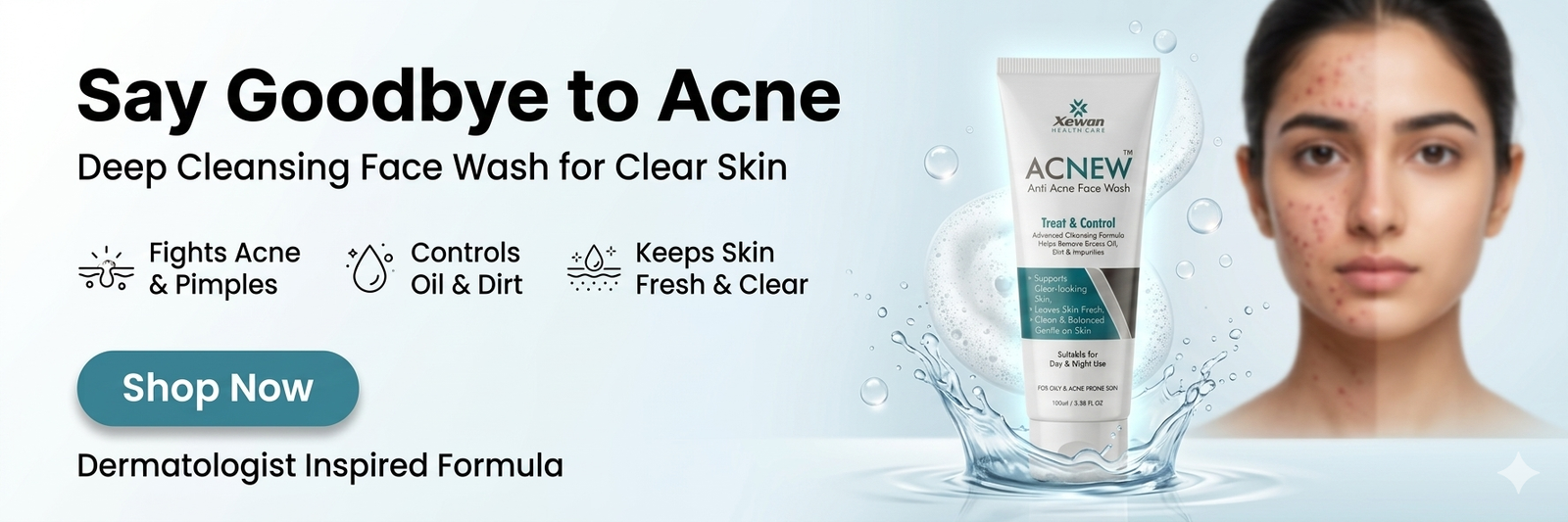 acnew facewash benner